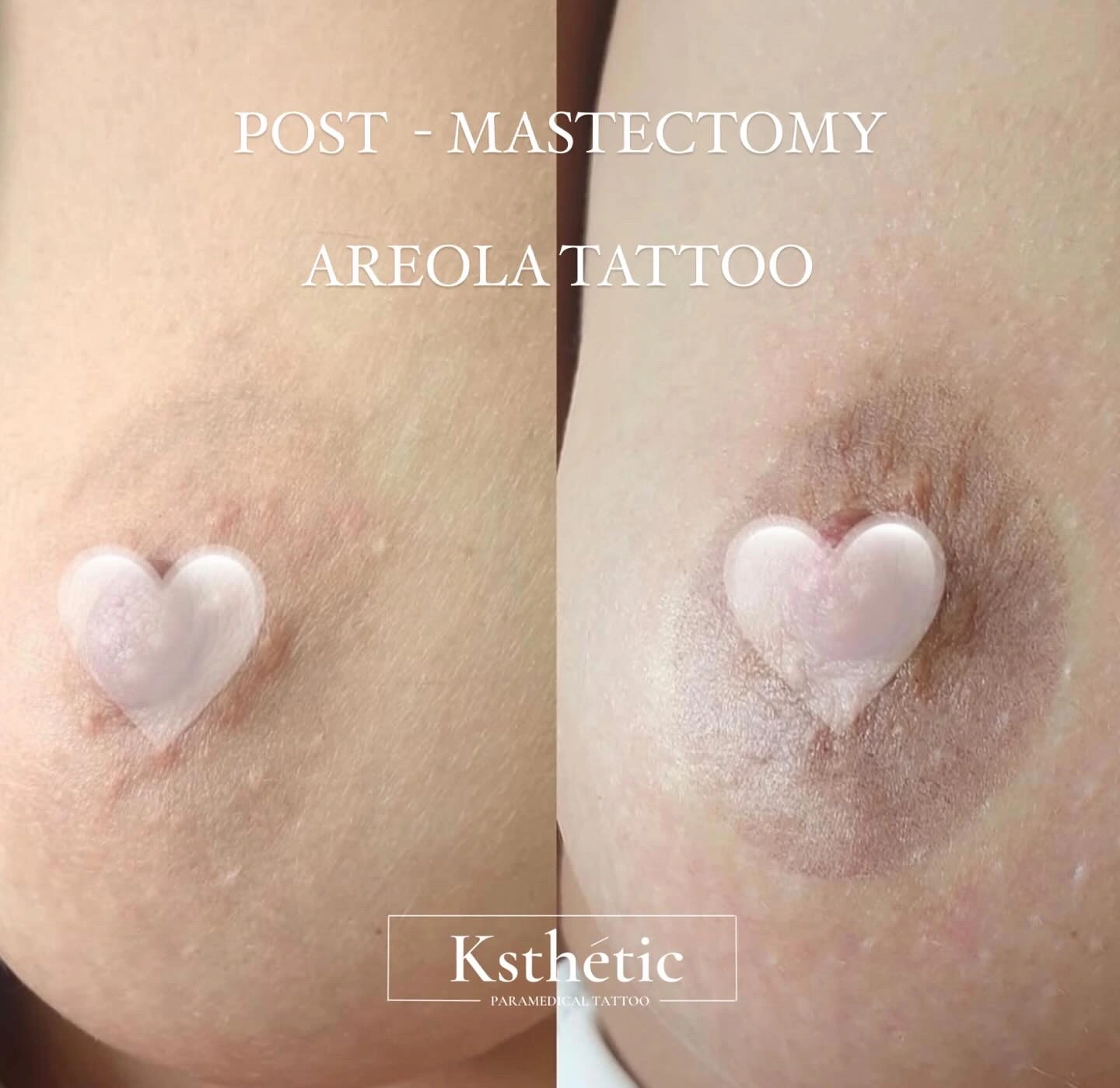 Areola Camouflage Areola Camouflage