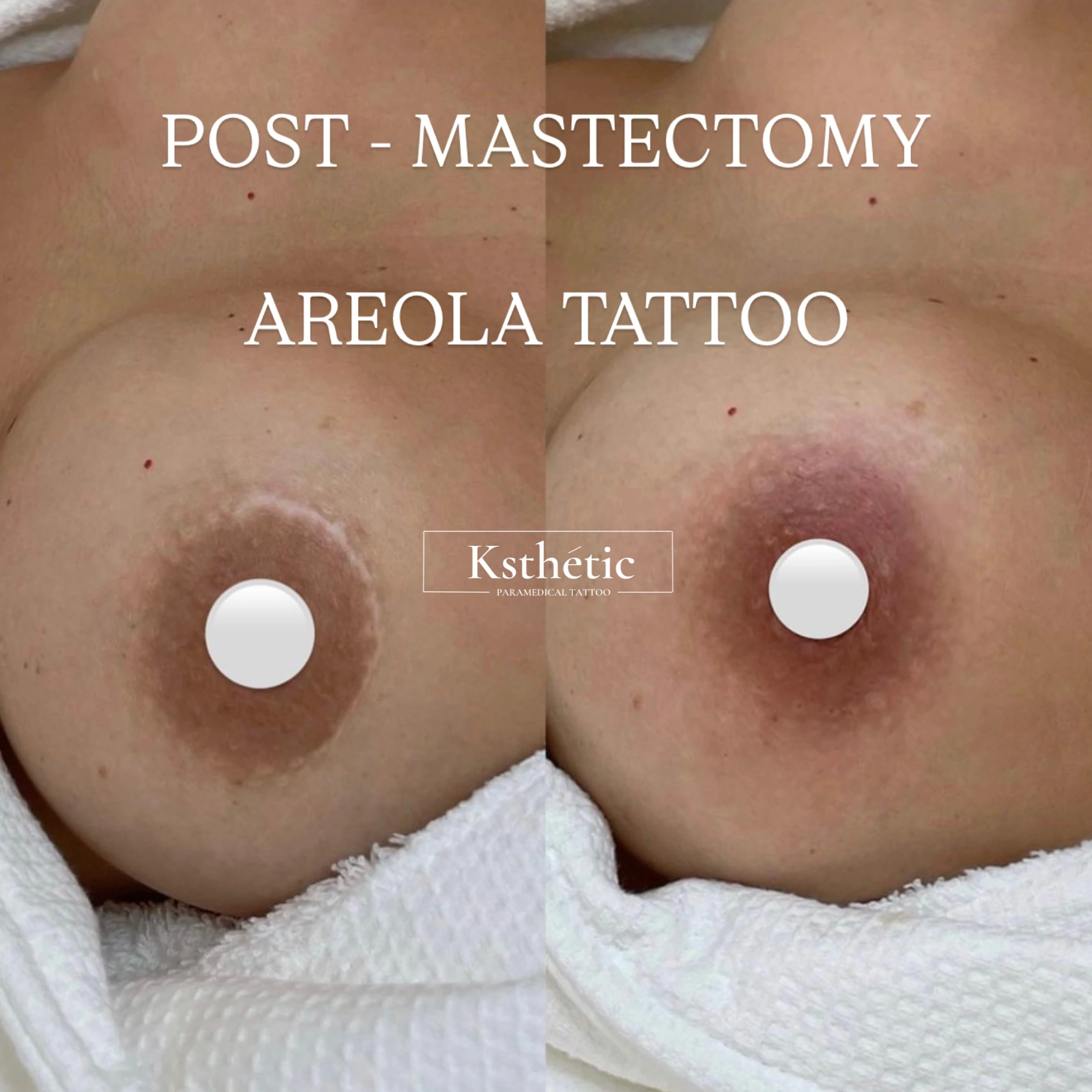 Areola Camouflage Areola Camouflage